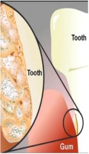 Biofilmresistenz