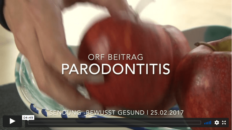 Video Parodontitis Patientin